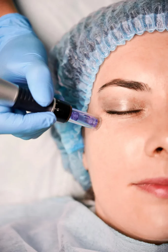 Lifting Treatment